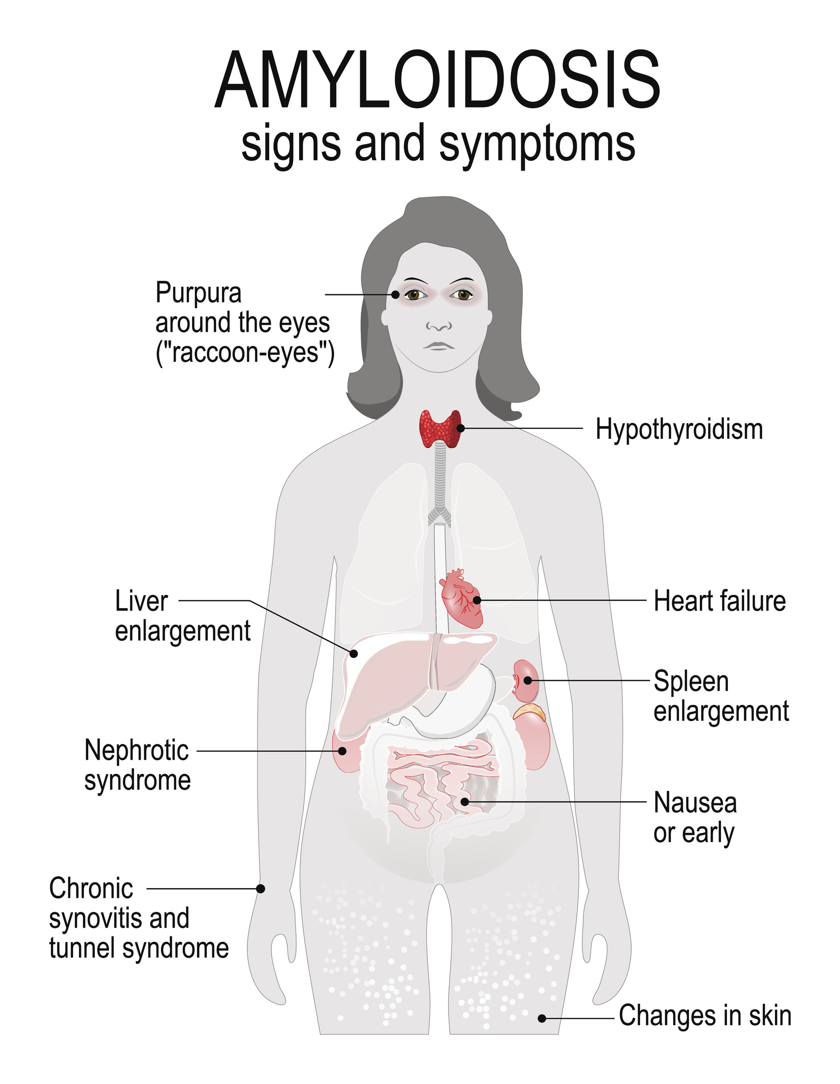 kidney failure symptoms