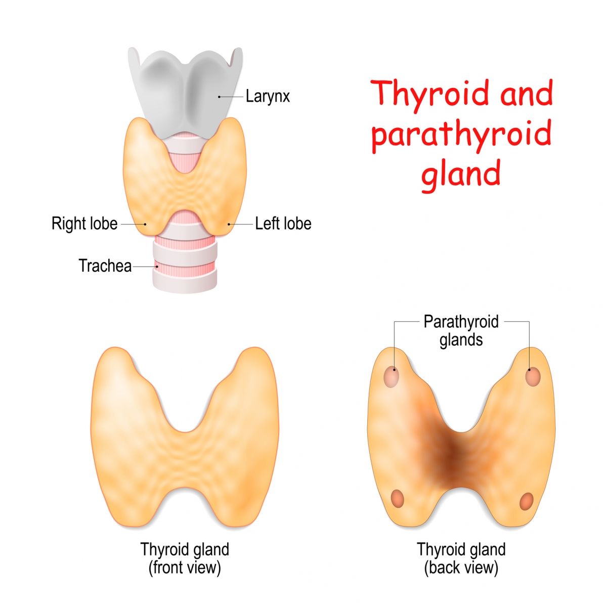 “you Want To Slit My Throat” What Is A Parathyroidectomy Dialysis