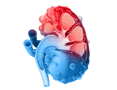 What is Polycystic Kidney Disease?